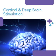 Deep Brain Stimulation (DBS)